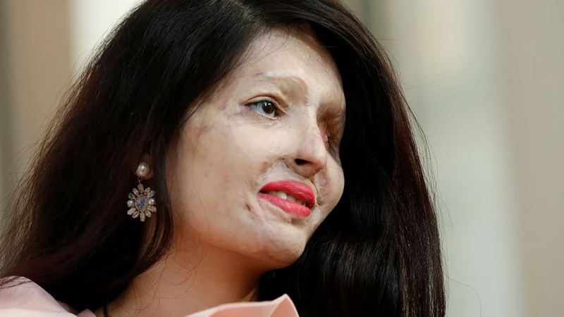 হাজারো অ্যাসিড আক্রান্ত নারীর কণ্ঠস্বর র্যাম্প মডেল রেশমা কুরেশি। ছবি: সংগৃহীত