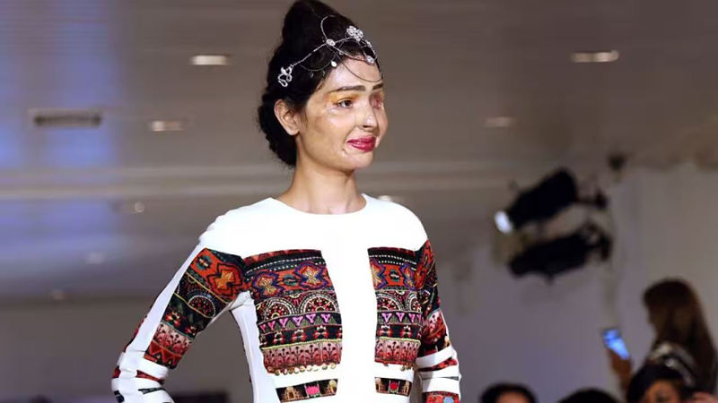 হাজারো অ্যাসিড আক্রান্ত নারীর কণ্ঠস্বর র্যাম্প মডেল রেশমা কুরেশি। ছবি: সংগৃহীত