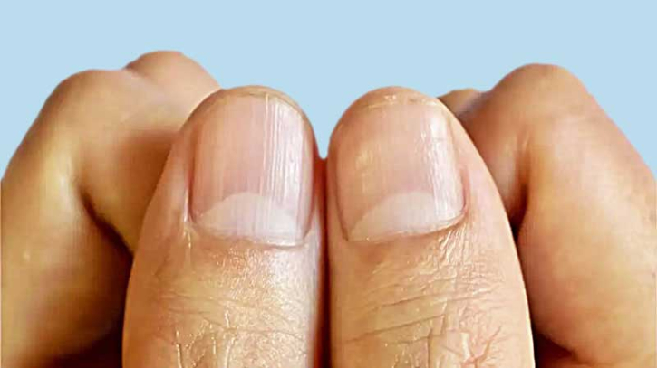নখের গোড়ায় অর্ধচাঁদ কোন রোগের সংকেত হতে পারে