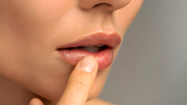 ঠোঁট ফাটছে ঘরে বসেই সমাধান করুন ঠোঁট ফাটছে ঘরে বসেই সমাধান করুন