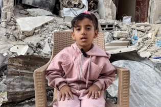 দগ্ধ শরীরে ছোট্ট মেয়ের জীবন সাজানোর লড়াই