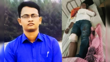 ডাকাত ধরতে গিয়ে হামলার শিকার পুলিশ কর্মকর্তা 