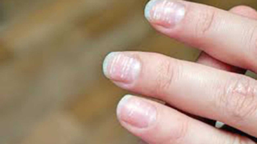 নারীদের শরীরে জিঙ্কের ঘাটতিতে বাড়ে জটিল রোগের ঝুঁকি! 