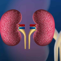 মাত্র ১৫ মিনিটের ব্যায়ামে কিডনি থাকবে সুস্থ: