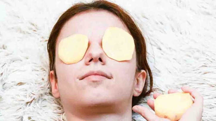 চোখের নিচে ডার্ক সার্কল, আলুর ঘরোয়া প্যাকেই ফিরে আসবে আপনার জেল্লা চোখের নিচে ডার্ক সার্কল, আলুর ঘরোয়া প্যাকেই ফিরে আসবে আপনার জেল্লা